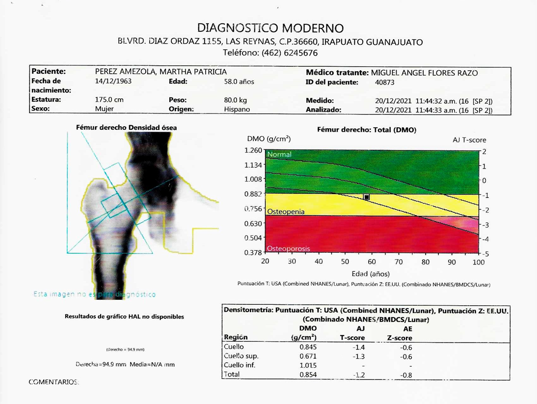 Otros Densitometria Osea Central