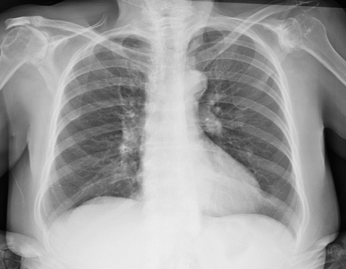 Estudios Radiologícos Rayos-X