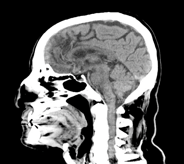 Estudios Radiologícos Tomografía Multicorte