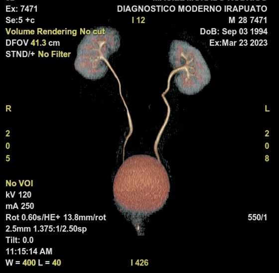 Estudios Radiologícos Urotomografía Contrastada