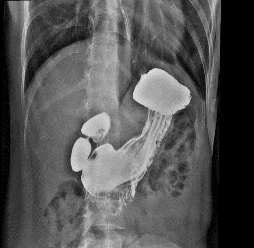 Estudios Radiologícos Radiografía